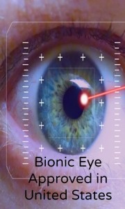 Bionic eye now approved in United States.