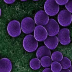 Superbug remains threat and resists antibiotics.